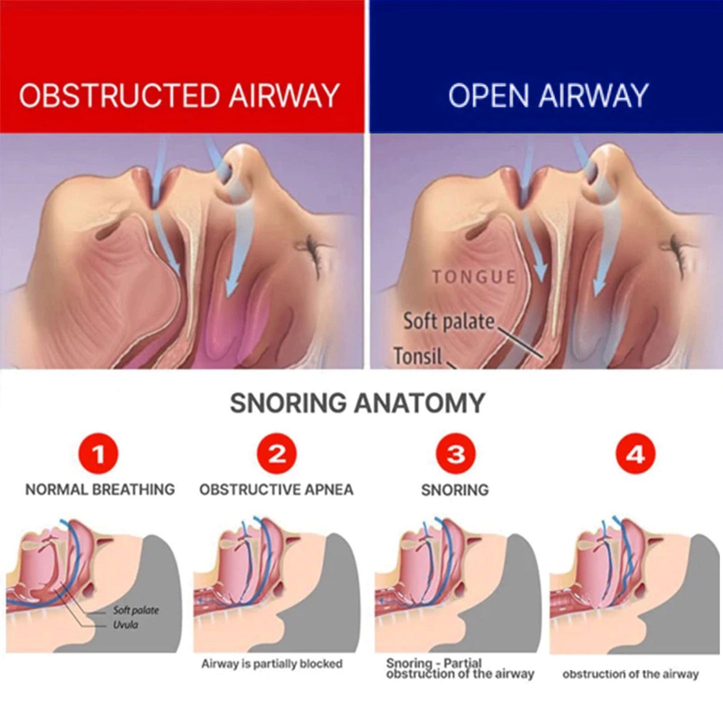 South Moon Adjustable Snoring Device, Correction At Night Help Sleep Cleaning Nasal Breathing Care Snore Stop Device