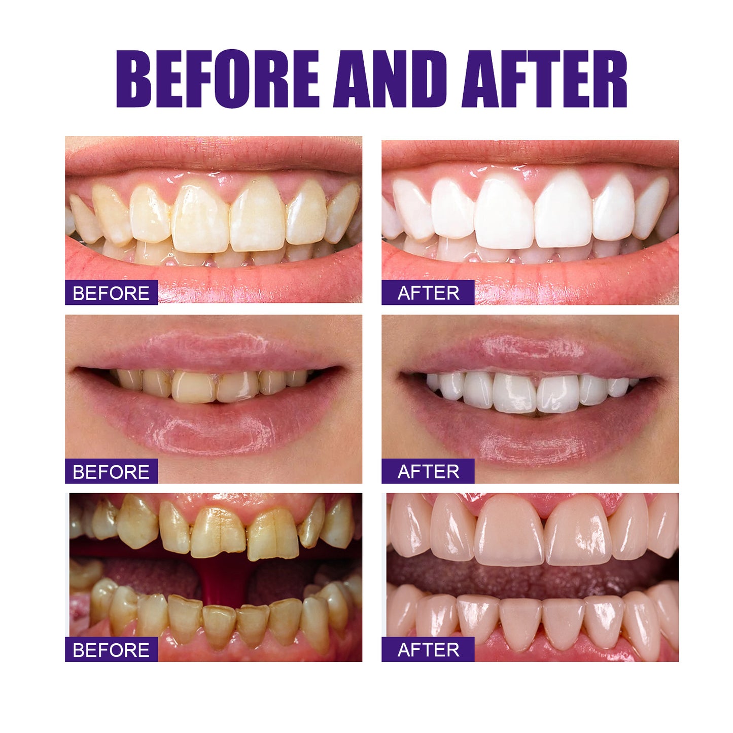 Jaysuing V34 Purple Toothpaste, Cleaning Bad Breath Teeth Stains Beauty Whitening Tooth Care Toothpaste