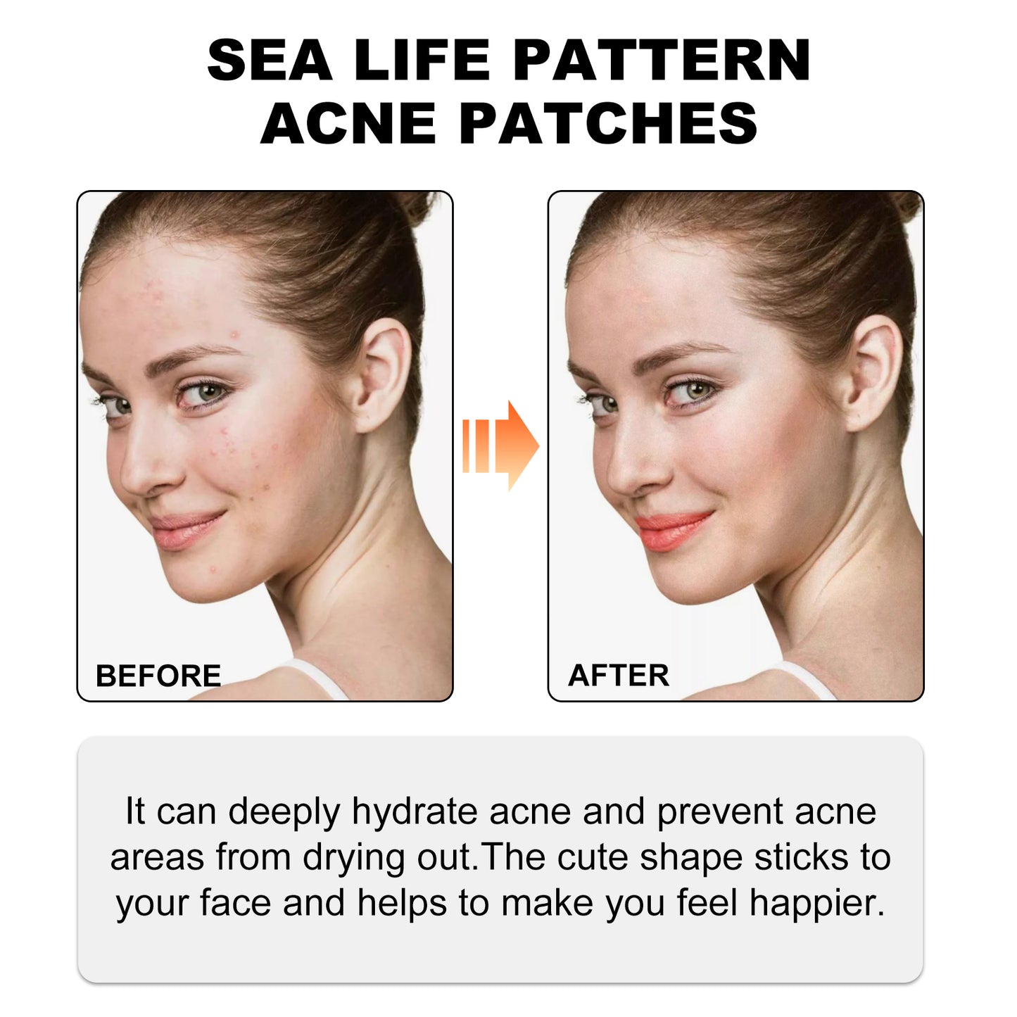 Hoygi Sea Life Pattern Acne Patches, Reduce Pimples Anti-Dryness Deep Hydrating Facial Cleanser