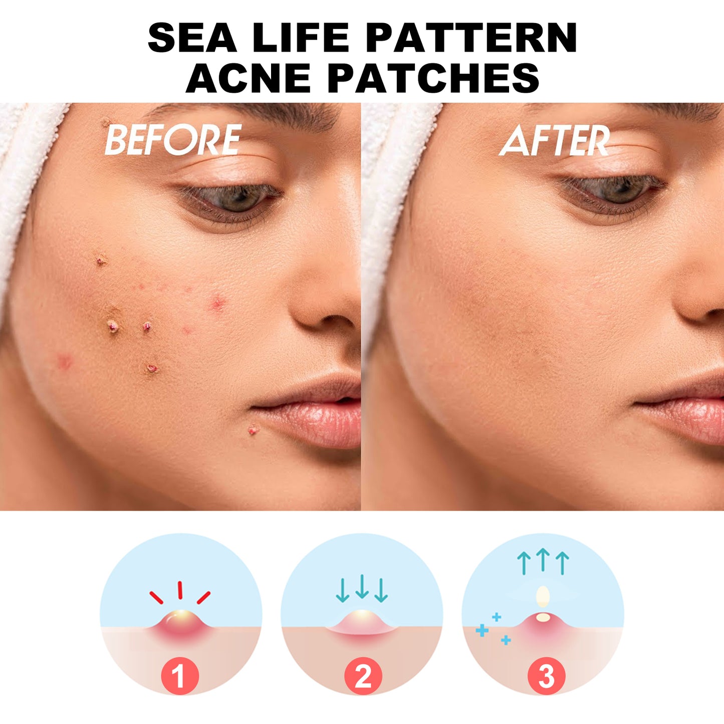 Hoygi Sea Life Pattern Acne Patches, Reduce Pimples Anti-Dryness Deep Hydrating Facial Cleanser